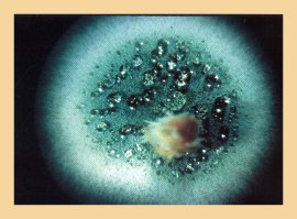 Penicillium